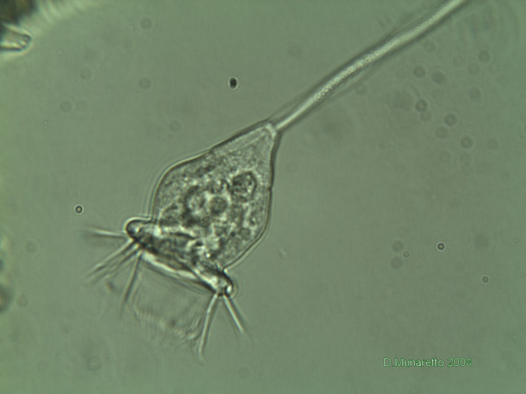 Vorticella sp.